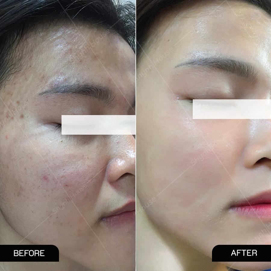 Da căng bóng, mịn màng giúp bạn trông trẻ hơn so với tuổi 