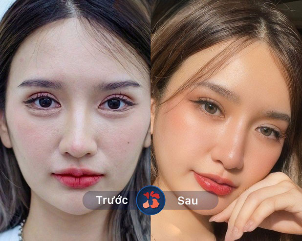 Cải thiện tình trạng trên, giúp lấy lại đôi mắt trẻ trung, linh hoạt Cải thiện tình trạng trên, giúp lấy lại đôi mắt trẻ trung, linh hoạt