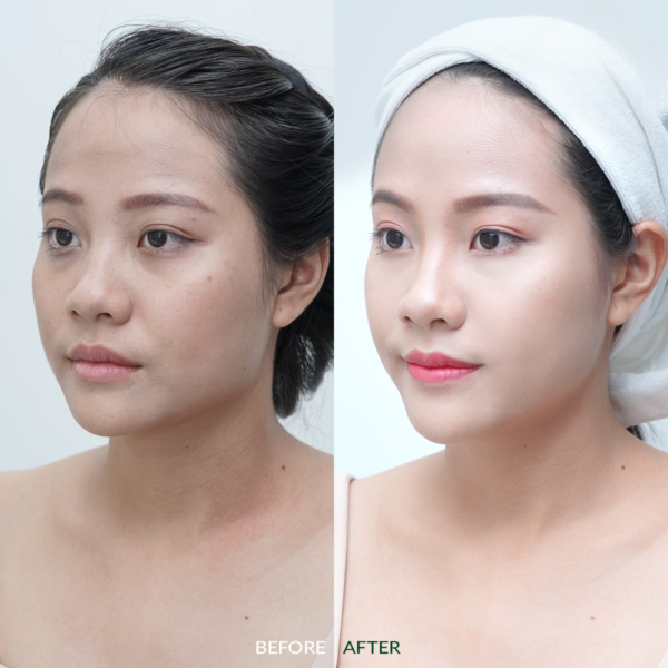 Da căng bóng, trắng sáng, tươi trẻ hơn