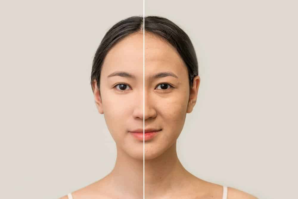 Xóa nhăn và cấp ẩm cho vùng da, giúp da căng mịn, đàn hồi Xóa nhăn và cấp ẩm cho vùng da, giúp da căng mịn, đàn hồi