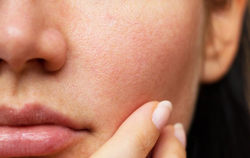 Càng lớn tuổi, lão hóa xuất hiện ngày càng nhiều và càng rõ Càng lớn tuổi, lão hóa xuất hiện ngày càng nhiều và càng rõ
