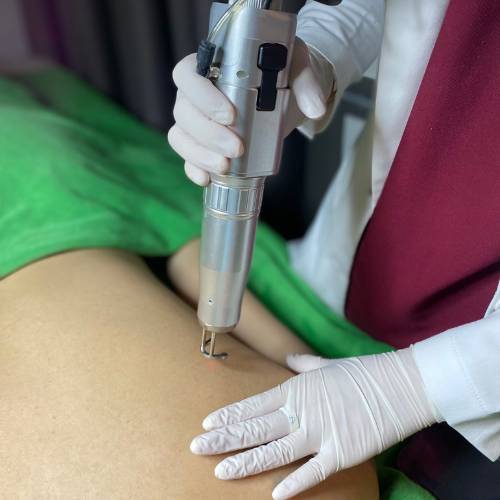 Sử dụng phương pháp như laser, peel da hoặc liệu pháp ánh sáng để loại bỏ mụn.